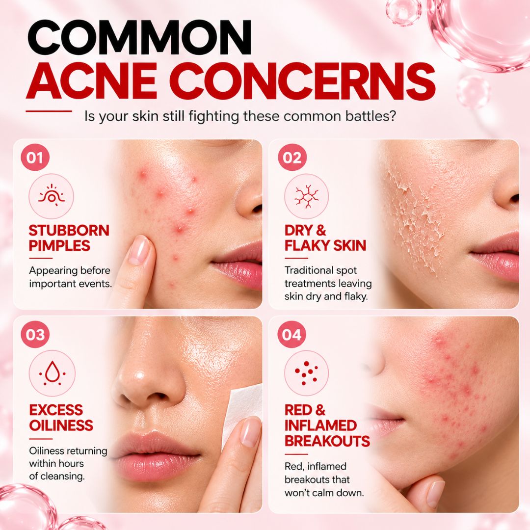 AcneNight™ Repair Serum