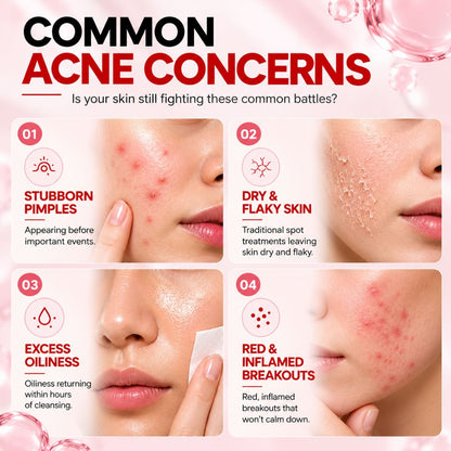 AcneNight™ Repair Serum