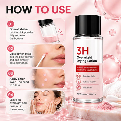 AcneNight™ Repair Serum
